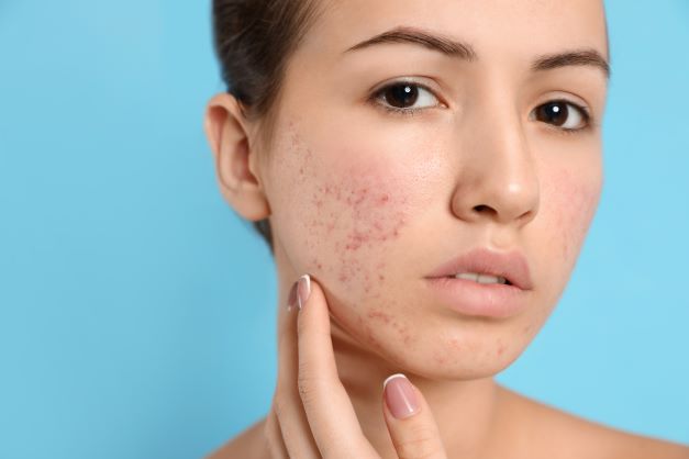 Best Dermatologist